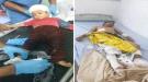 انفجار مقذوف حوثي يجرح 3 أطفال من أسرة واحدة غرب قعطبة بالضالع ...